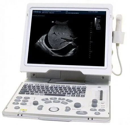 УЗИ аппарат Mindray DP-50 портативный УЗИ аппарат Mindray DP-50 портативный