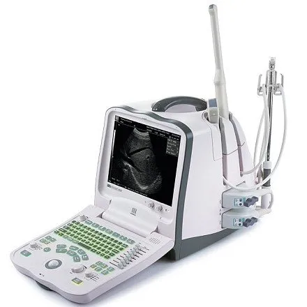 УЗИ аппарат Mindray DP-6900 портативный УЗИ аппарат Mindray DP-6900 портативный