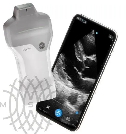 УЗИ аппарат GE HealthCare Vscan Air карманный