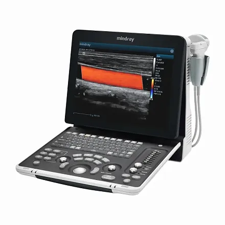 УЗИ аппарат Mindray Z60 Exp портативный УЗИ аппарат Mindray Z60 Exp портативный