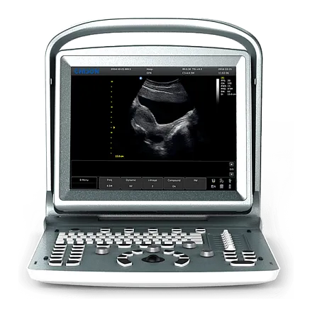 Chison SonoTouch 20 УЗИ аппарат портативный Chison SonoTouch 20 УЗИ аппарат портативный