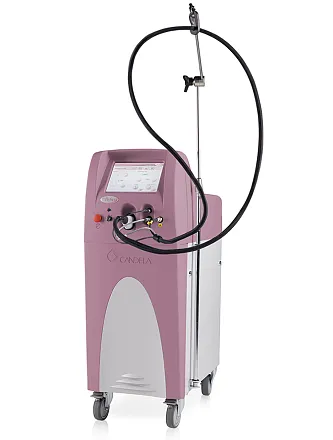 Лазер на красителе CANDELA VBeam Perfecta 595 Лазер на красителе CANDELA VBeam Perfecta 595