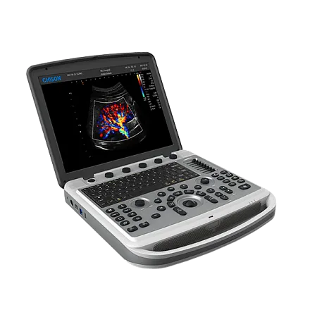 УЗИ аппарат Chison SonoBook 6 портативный УЗИ аппарат Chison SonoBook 6 портативный