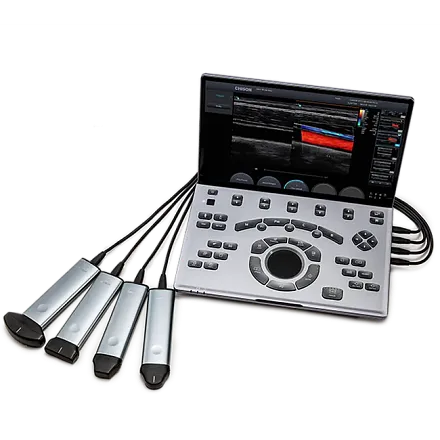 УЗИ аппарат Chison SonoTouch 50 (Sonoair) портативный УЗИ аппарат Chison SonoTouch 50 (Sonoair) портативный