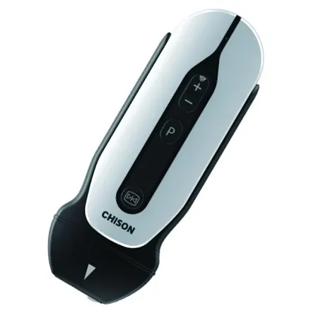 Chison Sonotouch 30 (Sonoeye) портативный УЗИ аппарат Chison Sonotouch 30 (Sonoeye) портативный УЗИ аппарат