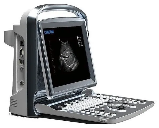 Chison SonoTouch 10 УЗИ аппарат портативный Chison SonoTouch 10 УЗИ аппарат портативный