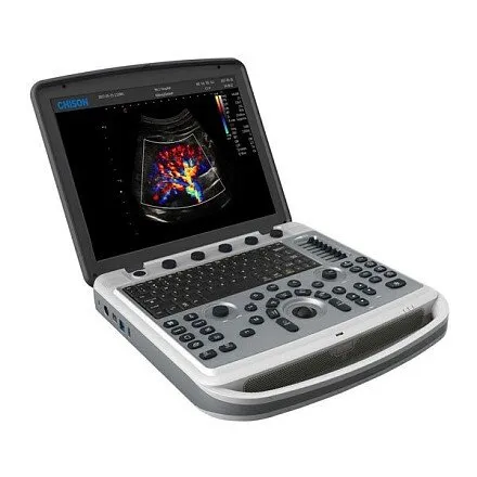 УЗИ аппарат Chison SonoBook 9 портативный УЗИ аппарат Chison SonoBook 9 портативный