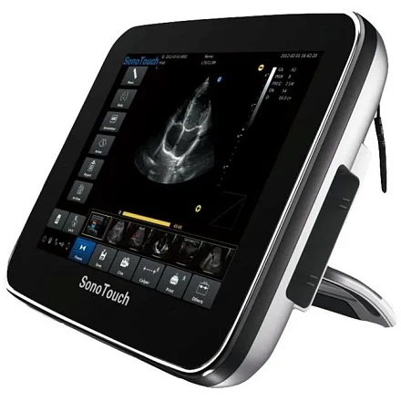 Chison SonoTouch 30 портативный УЗИ аппарат Chison SonoTouch 30 портативный УЗИ аппарат