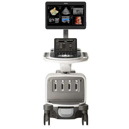Philips EPIQ Elite ультразвуковой аппарат Philips EPIQ Elite ультразвуковой аппарат