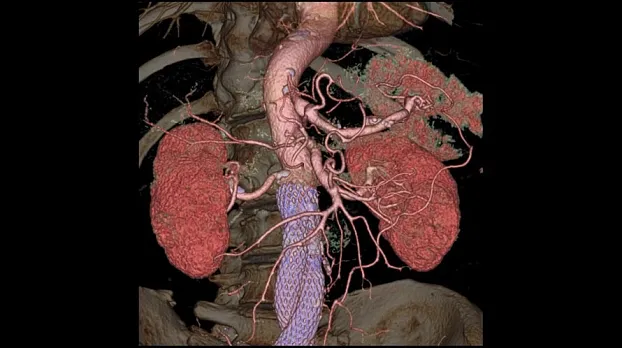 Клинические изображения Компьютерный томограф GE Discovery RT