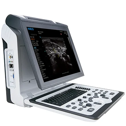 SIUI Apogee 1100 УЗИ аппарат портативный SIUI Apogee 1100 УЗИ аппарат портативный