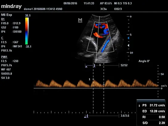 Клинические изображения Mindray M5 New Premium